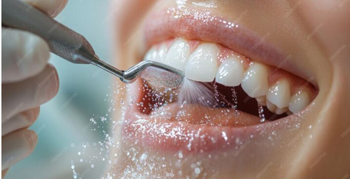 Igiene Dentale GBT